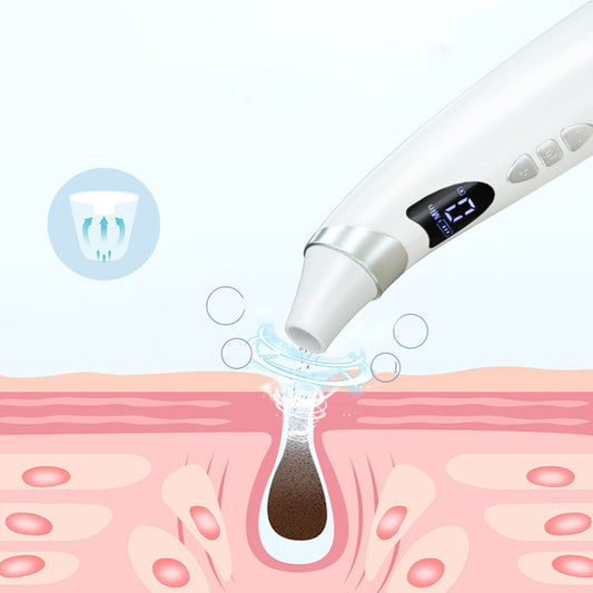 Electric Blackhead Remover & Pore Vacuum  Deep Cleansing Facial Suction Tool for Clear, Healthy Skin